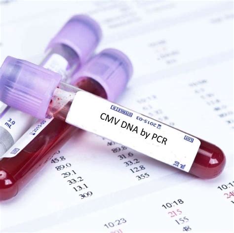 cmv pcr blood test bottle|cmv pcr time.